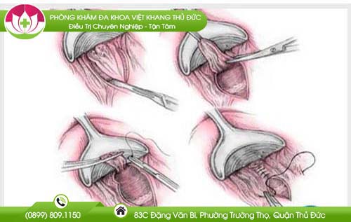 dia-chi-benh-vien-chua-benh-tri-binh-tan