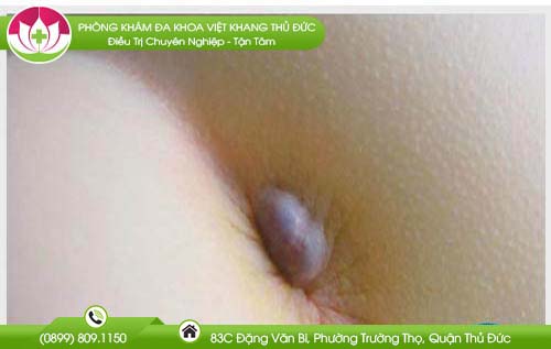 dia-chi-benh-vien-chua-benh-tri-can-gio