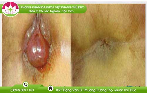 dia-chi-benh-vien-chua-benh-tri-dac-lac