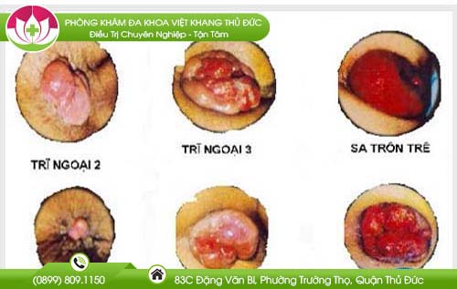 dia-chi-benh-vien-chua-benh-tri-dong-thap
