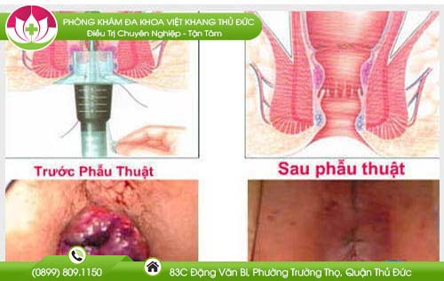 dia-chi-benh-vien-chua-benh-tri-gia-lai