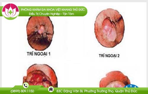 dia-chi-benh-vien-chua-benh-tri-hoc-mon