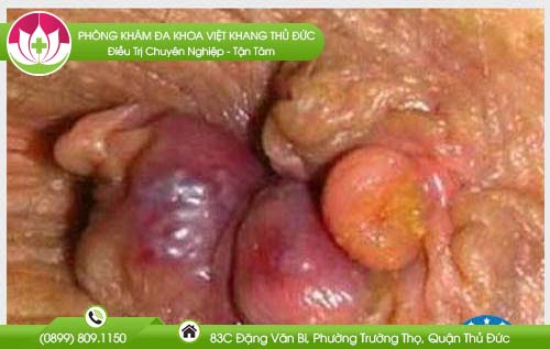 dia-chi-benh-vien-chua-benh-tri-khanh-hoa