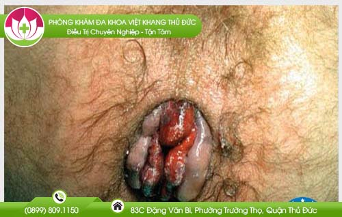 dia-chi-benh-vien-chua-benh-tri-kon-tum
