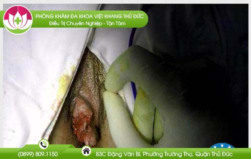 dia-chi-benh-vien-chua-benh-tri-lam-dong