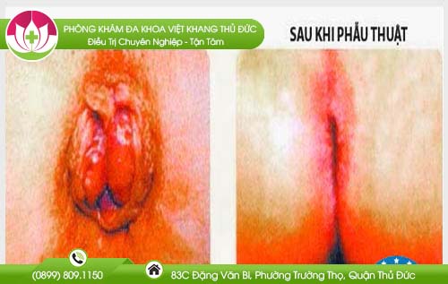 dia-chi-benh-vien-chua-benh-tri-nha-be