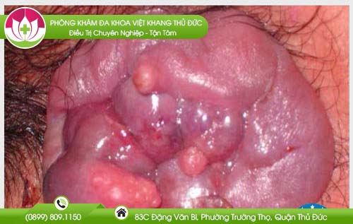dia-chi-benh-vien-chua-benh-tri-phu-nhuan