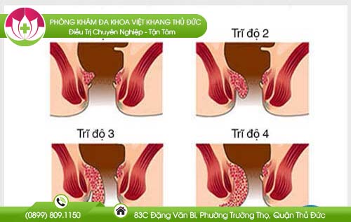 dia-chi-benh-vien-chua-benh-tri-quan-10
