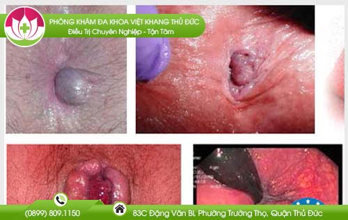 dia-chi-benh-vien-chua-benh-tri-quan-11
