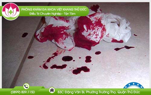 dia-chi-benh-vien-chua-benh-tri-quan-11
