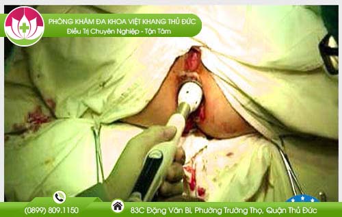 dia-chi-benh-vien-chua-benh-tri-quan-11
