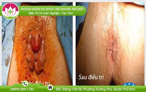 dia-chi-benh-vien-chua-benh-tri-quan-11