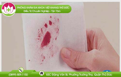 dia-chi-benh-vien-chua-benh-tri-quan-5