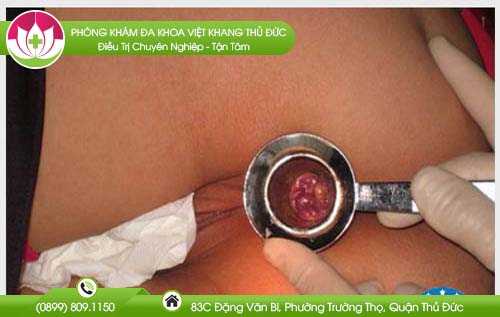dia-chi-benh-vien-chua-benh-tri-tai-go-vap