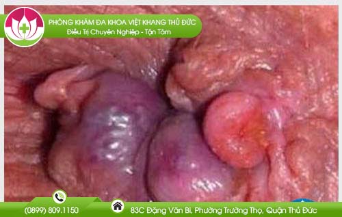 dia-chi-benh-vien-chua-benh-tri-tan-binh