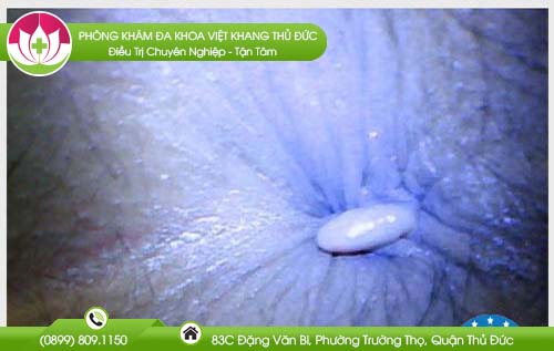 dia-chi-benh-vien-chua-benh-tri-tan-phu