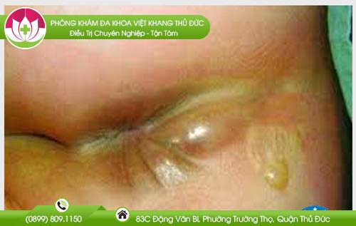 dia-chi-benh-vien-chua-benh-tri-tien-giang