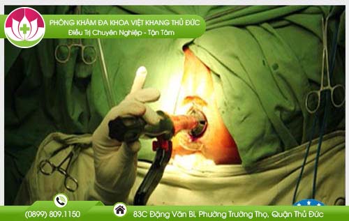 Mách nhỏ địa chỉ bệnh viện chữa bệnh trĩ Tiền Giang khỏi bệnh nhanh