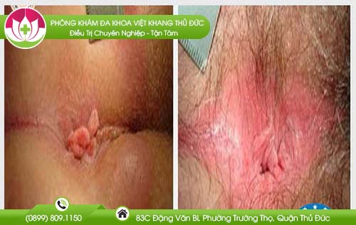 dia-chi-benh-vien-chua-benh-tri-vinh-long