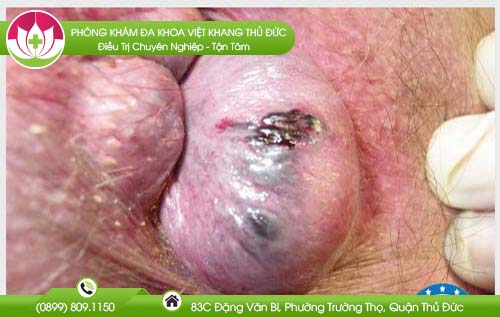 dia-chi-benh-vien-chua-benh-tri-vung-tau