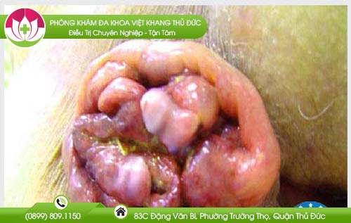 dia-chi-benh-vien-chua-benh-tri-vung-tau