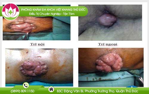dia-chi-benh-vien-chua-tri-quan-8