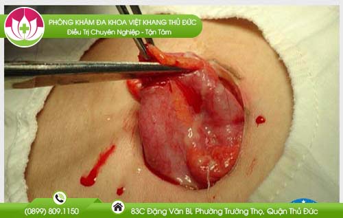 dia-chi-benh-vien-chua-tri-quan-9
