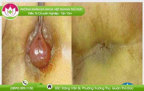 dia-chi-benh-vien-chua-tri-quan-9