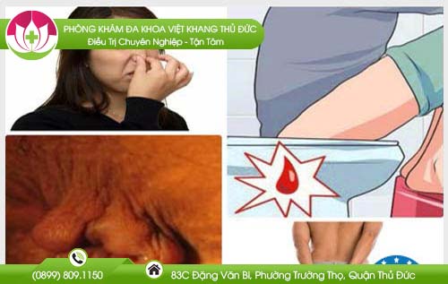 dia-chi-benh-vien-chua-tri-quan-binh-thanh