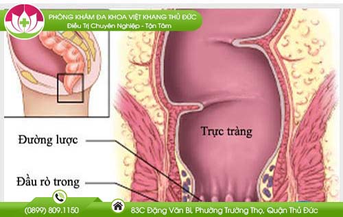 dieu-tri-benh-mach-luon-o-dau-tot-nhat