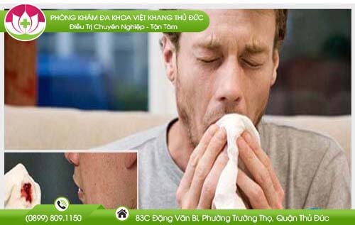 Dấu hiệu đờm màu đen là bệnh gì? Có mắc bệnh nguy hiểm không?