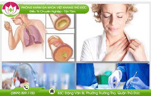 Cách điều trị đờm trong cổ họng thường xuyên hiệu quả lại nhanh chóng