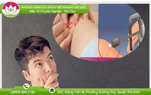 Đốt sùi mào gà có để lại sẹo không