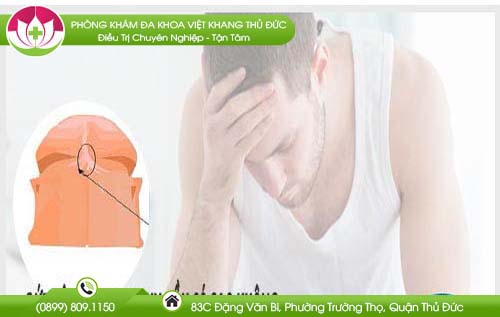 Đứt dây hãm bao quy đầu có sao không điều nam giới cần biết