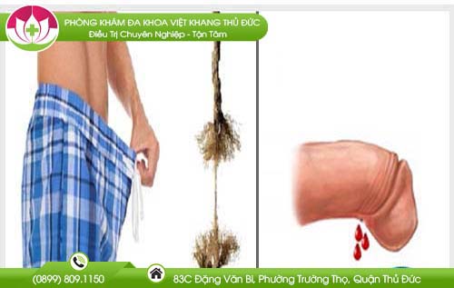 dut-day-ham-bao-quy-dau-co-sao-khong