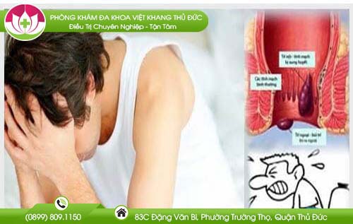 Hẹp hậu môn và phương pháp điều trị bệnh hiệu quả