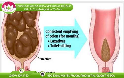 hep-hau-mon