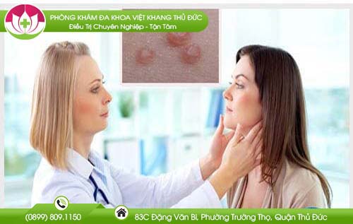 Nhận biết hình ảnh bệnh u mềm lây ở nam giới và nữ giới