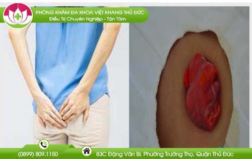 hinh-anh-hau-mon-phu-nu