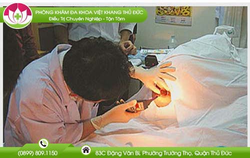 hinh-anh-hau-mon-phu-nu