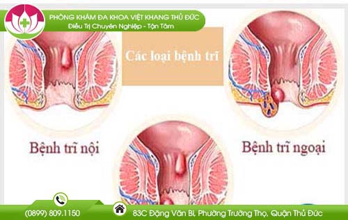 kham-benh-tri-o-khoa-nao