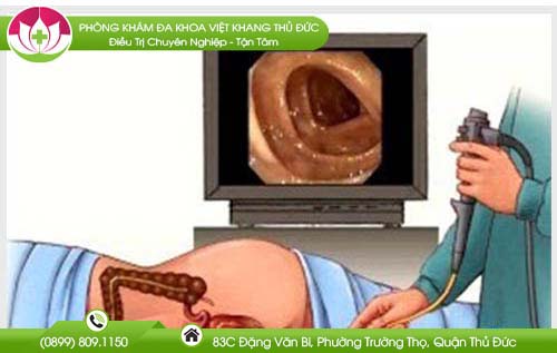 kham-hau-mon-truc-trang