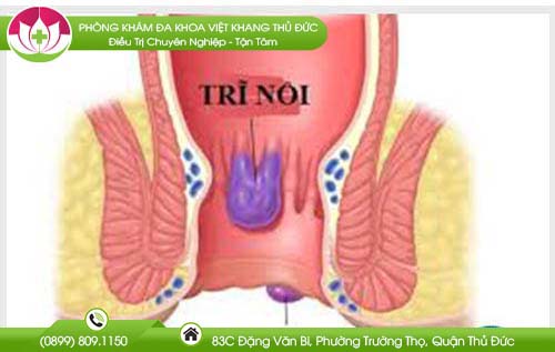 kham-hau-mon-truc-trang