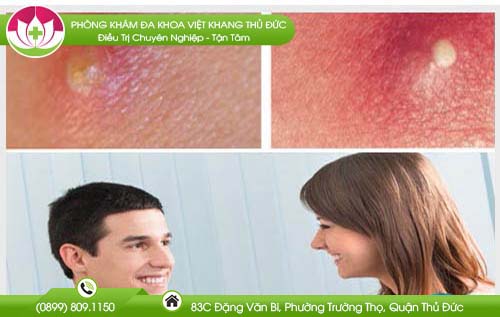 Gợi ý địa chỉ khám mụn nhọt ở đâu tốt dành cho người bệnh