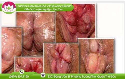 kinh-nghiem-chua-benh
