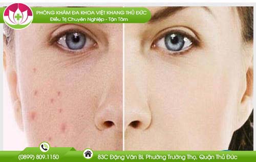 la-dau-tam-co-tac-dung-gi-khong-phai-ai-cung-biet