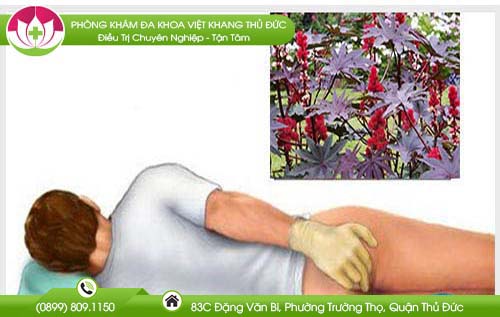 Lá thầu dầu tía thần dược vàng chữa bệnh trĩ bạn nên biết