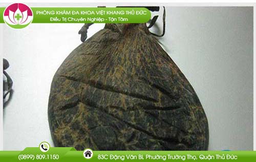 mat-gau-chua-benh-tri-co-hieu-qua-khong