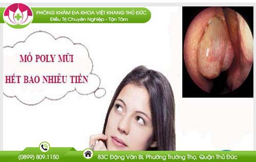Chi phí một ca mổ polyp mũi hết bao nhiêu tiền? Bảng giá 2018