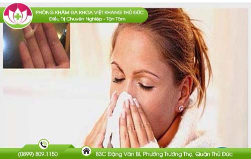 Phải làm sao khi mũi có mùi hôi tanh? Mẹo chữa bệnh